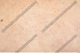 human skin hairy 0009